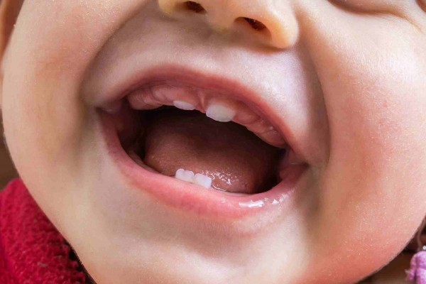 دندان درآوردن نوزاد | زمان و علائم دندان درآوردن نوزاد…